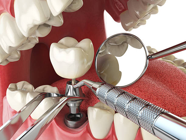 Best Emergency Denture Repair in Las Lomas, TX